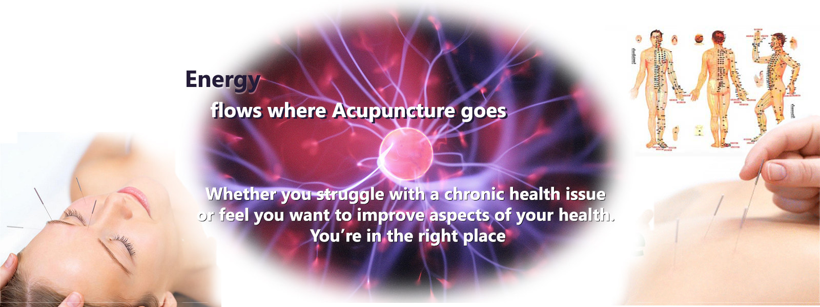 Acupuncture in Riverside
